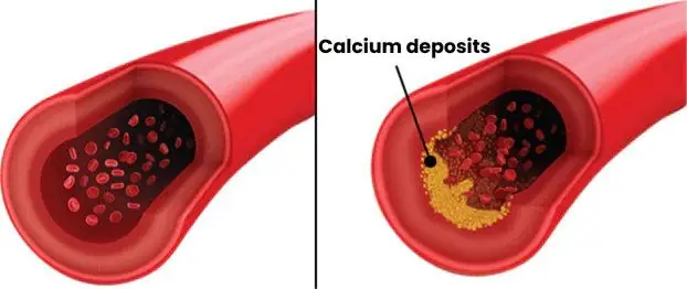 Blood vessel illustration